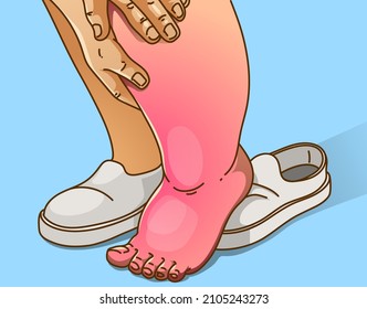 Edema Foot, Healthcare Illustration. Vector Illustration