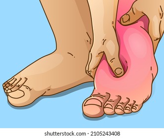 Edema Foot, Healthcare Illustration. Vector Illustration