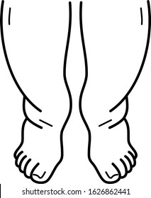 Edema And Swollen Legs Line Art Icon 