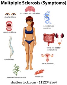 An Education Poster of Multiple Sclerosis illustration