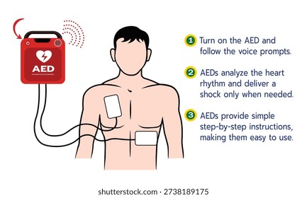 Educational infographic illustrating how to use an automated external defibrillator (AED) with clear step-by-step instructions. Designed for first aid training, emergency response, and public safety awareness