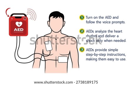 Educational infographic illustrating how to use an automated external defibrillator (AED) with clear step-by-step instructions. Designed for first aid training, emergency response, and public safety awareness
