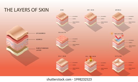 Educational lessons about the layers of the skin in humans. Human skin condition