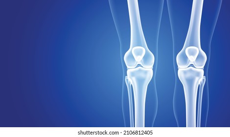 Educational medical illustration of leg bones and knee.