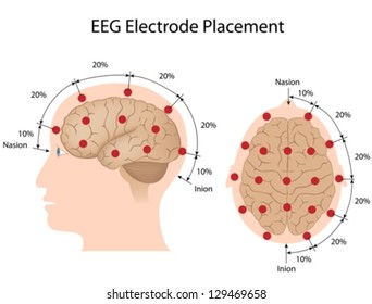 EEG electrode placement