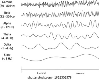 EEG (electroencephalogram) waveforms. Slow, Delta, Theta, Alpha Beta and Gamma waves.