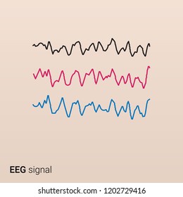 An EEG Signal Of The Brain. Electroencephalography