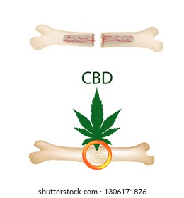 Effect of cannabis oil on bones and fractures. Cannabinoid treatment. Marijuana properties. Vector illustration on isolated background.