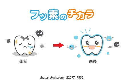 Wirkung der Behandlung mit FluorInnenZusammen mit dem CharakterDentalgrafik[Übersetzung:Wirkungen der Anwendung von Fluorid]