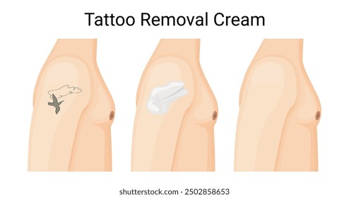 Crema de eliminación efectiva de tatuajes para una Ilustración vectorial de la piel clara