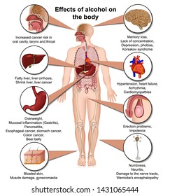 Effects of alcohol on the body 3d medical vector illustration isolated on white background eps 10 infographic