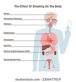 Effects of cigarette smoking on human body. Health issues and risks of smokers. Human internal organs diseases caused by nicotine. Flat vector illustration