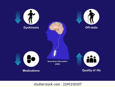 Effects of deep brain stimulation for treatment of advanced Parkinson's disease. Vector illustration.