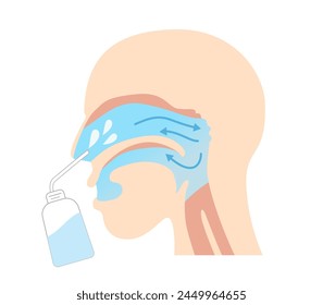 Effects and methods of nasal gargling. How to clean the nasopharynx[鼻うがい], Nasal Cleansing, nasal gargling