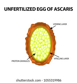 The egg of the roundworm unfertilized. Structure of Ascaris eggs. infographics. Vector illustration on isolated background.