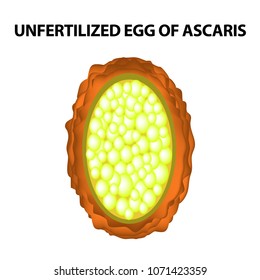 The egg of the roundworm unfertilized. Structure of Ascaris eggs. infographics. Vector illustration on isolated background.