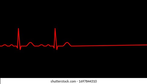 Ekg Line. Heartbeat. Heart Stops Beating. Death. Electrocardiography. Vector Illustration.