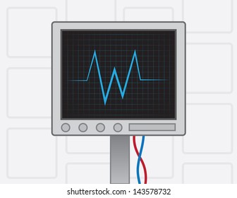 EKG Machine On With Wires 