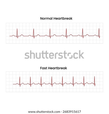 EKG showing comparison of normal and fast heartbeat rhythms, ideal for heart health education content, flat art design style.
