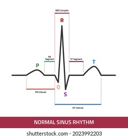 El electrocardiograma muestra una ola normal de latido del corazón. ECG de diagrama de infografía normal de ritmo sinusal.