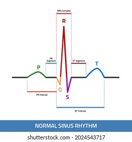 EKG Showing Normal Heartbeat Wave. ECG Of Normal Sinus Rhythm Infographic Diagram.