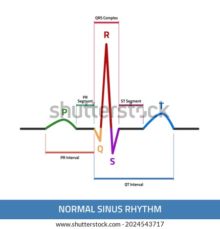 EKG showing normal heartbeat wave. ECG of Normal Sinus Rhythm infographic diagram.