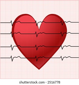 ekg with smaller square chart behind vector