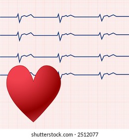 ekg vector