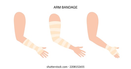 Banda elástica en el brazo humano. Gasa médica sobre un codo y una muñeca. Ligamentos rotos o lesionados, rociados. Atención médica y primeros auxilios. Paciente con ilustración vectorial de fractura de mano.