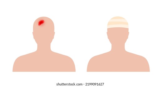 Elastic Bandage On Human Head. Concussion, Sore Or Headache. Roll And Wrap Medical Gauze Over Skull. Broken Or Injured Part Of Body. Healthcare And First Help. Patient With Trauma Vector Illustration