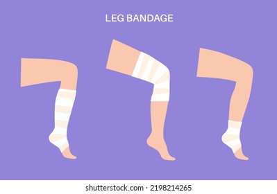 Elastic bandage on human leg. Roll and wrap medical gauze over a knee. Broken or injured joint, sprained ligaments. Healthcare and first help concept. Ankle trauma flat vector illustration