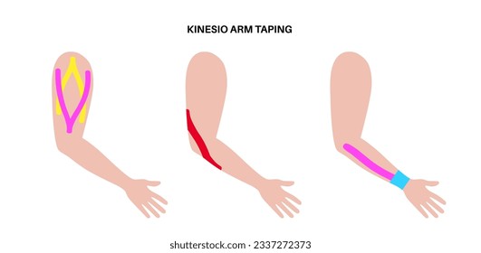 Elastic therapeutic tape. Kinesiology tape on arm. KT method, elastic strip purported to ease pain from injuries. Protection and fixation for elbow muscles and wrist ligaments vector illustration.