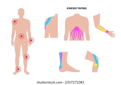 Elastic therapeutic tape. Kinesiology tape on arm, leg, shoulder and abdomen. KT method, elastic strip purported to ease pain from injuries. Protection for muscles and ligaments vector illustration