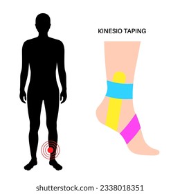 Elastic therapeutic tape. Kinesiology tape on the human ankle. KT method, elastic strip purported to ease pain from athletic injuries. Protection for muscles and ligaments flat vector illustration.