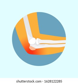elbow and bone, Elbow degeneration, vector illustration