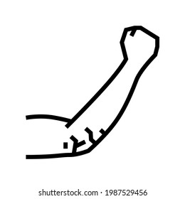 elbow dry skin line icon vector. elbow dry skin sign. isolated contour symbol black illustration