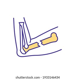 Elbow fracture RGB color icon. Visible arm deformity. Broken bones. Sudden, intense pain. Joint surface damage. Nerve damage. Muscles sprains, strains and dislocations. Isolated vector illustration