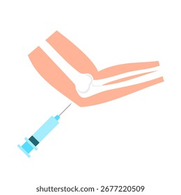 Ilustração do vetor de injeção do cotovelo. Um cotovelo recebendo uma injeção. Conceito de tratamento ortopédico. Artrite, bursite, inflamação das articulações, drenagem. Lesões esportivas e reabilitação de fisioterapia.