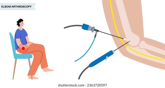 Elbow joint minimally invasive surgery. Arthroscopy medical procedure. Anatomy of humerus, ulna and radius bones. Arm pain, fracture, osteoarthritis or rheumatoid arthritis x ray vector illustration