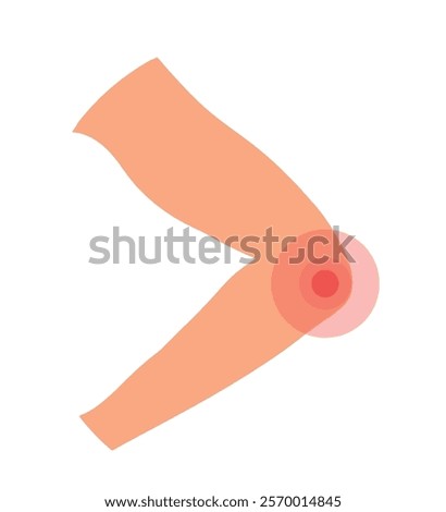 Elbow pain, arthritis symptom thin line icon. Joint inflammation, bursitis, golfer's elbow, osteoarthritis, rheumatoid arthritis, sprain, tendonitis, tennis elbow, nerve compression. Vector illustrati
