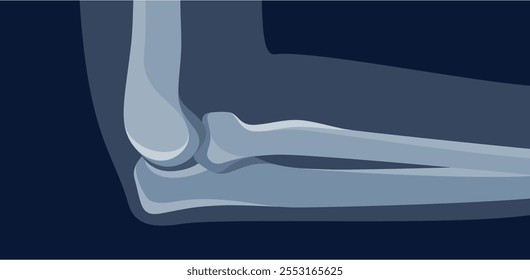 Elbow xray roentgen image orthopedic diagnosis medical aid vector flat illustration. Patient human joint x ray anatomy arthritis inflammation medicine surgery pain surgery radiologist shot