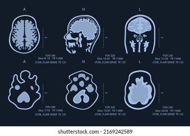 Elderly man brain scan image on MRI magnetic resonance imaging film for neurological medical diagnosis of brain diseases