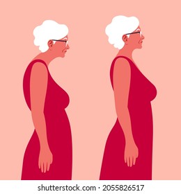 An Elderly woman with a bad posture. Spine. Profile. Kyphosis. Flat vector illustration on red background. Minimalism