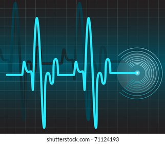  Electrocardiogram