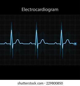 Electrocardiogram 2d illustration on black background, vector, eps 10