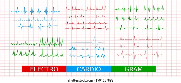 Electrocardiogram eartbeat line, collection of cardiogram line icons. Set of signs for infographic, logo, app development, web design. Electrocardiogram on paper background. ECG heart line.