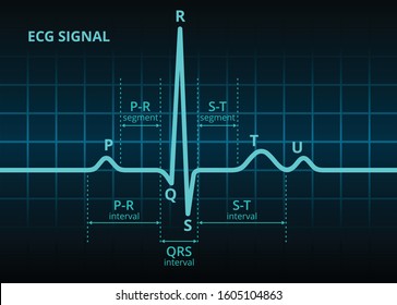 Electrocardiogram ECG or EKG blue heart beat signal pulse monitor oscilloscope