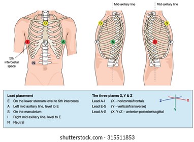 Electrocardiogram (ecg, Ekg) Lead Placement And A Description Of The Leads Result In 3 Planes Of Signal Detection.