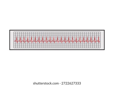 Elektrokardiogramm-Diagramm mit konstantem Herzrhythmus auf medizinischem Graphpapier
