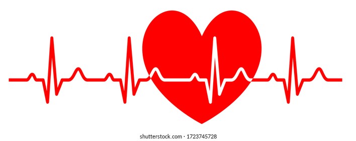 gráficos electrocardiográficos de calidad vectorial